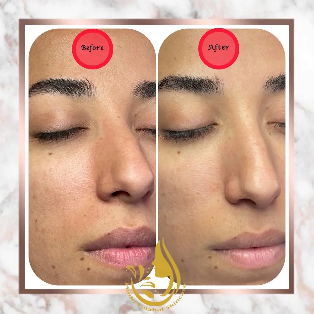 گالری مرکز تخصصی فشیال و پاکسازی حدیث فلاحت